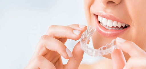 Why Many Are Choosing Clear Aligners in Singapore for a More Confident Smile