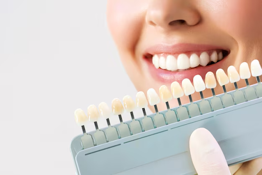 Cosmetic Teeth Whitening in Colorado