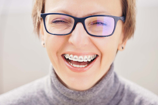 From Traditional Braces to Clear Aligners: Exploring Adult Orthodontic Options